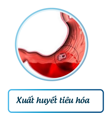 Polyp đường tiêu hóa